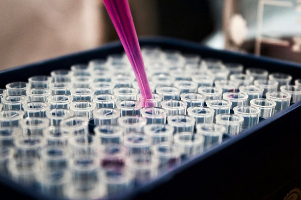 L'importance des centrifugeuses dans les avancées de la recherche en laboratoire